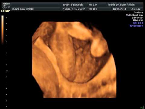 Junge Ultraschallbild