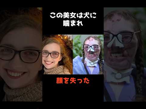 ニュースの動画サムネイル - 【ペットシッターをしたら顔を失った美女】 #shorts #事件解説 #警察