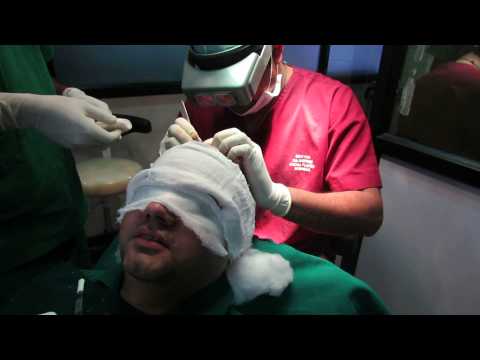 Best Hair Transplant Doctor in Bangalore, India