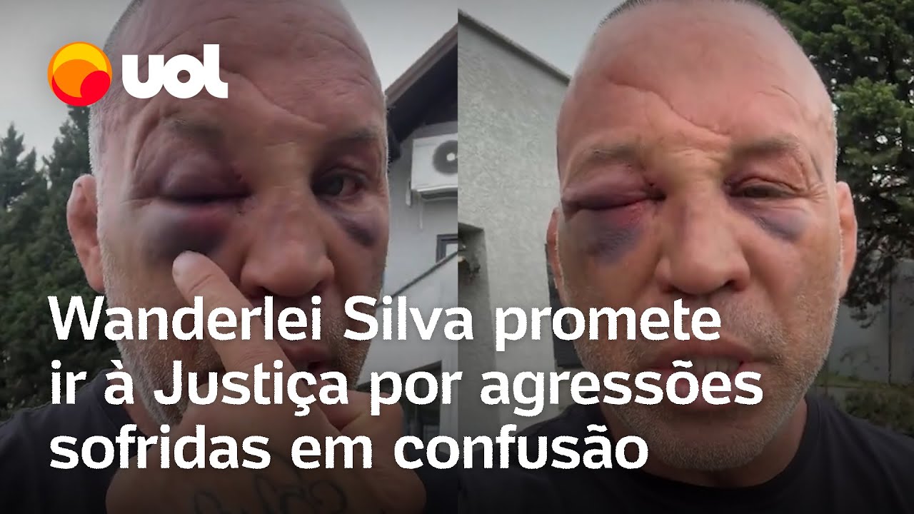 Ato criminoso Wanderlei Silva promete ir à Justiça por agressões sofridas em confusão