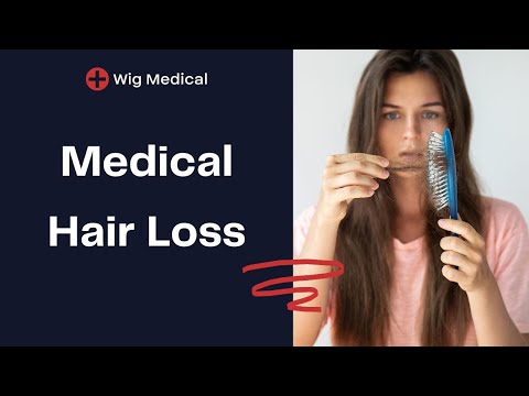 The Most Common Types of Medical Related Hair Loss