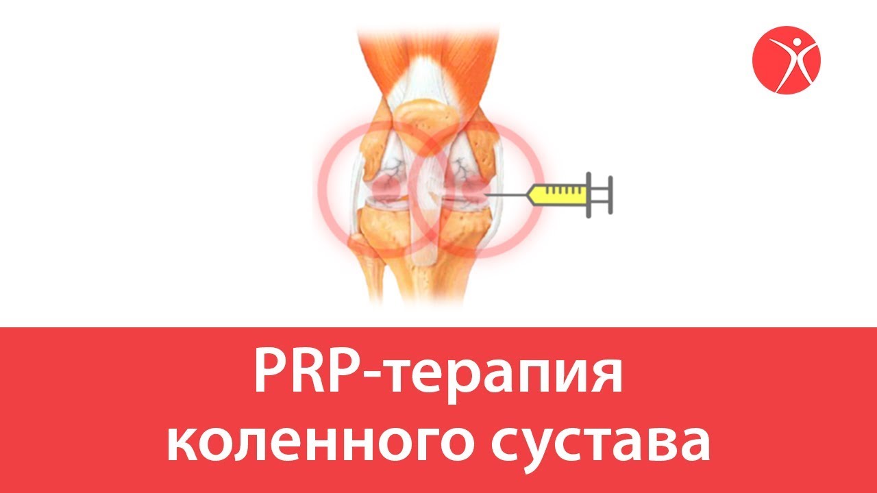 Prp Терапия Для Суставов Цена Отзывы