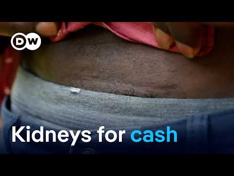 Kenya at the center of brutal global Kidney trade | DW News