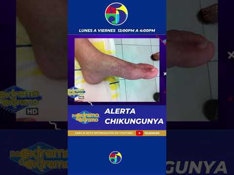 ⚠ ALERTA CHIKUNGUNYA ⚠