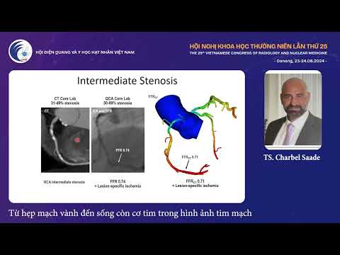 2. Từ hẹp mạch vành đến sống còn cơ tim trong hình ảnh tim mạch (TS. Charbel Saade)
