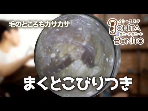 #耳掃除　まくとこびりつき！毛の所のカサカサ👂