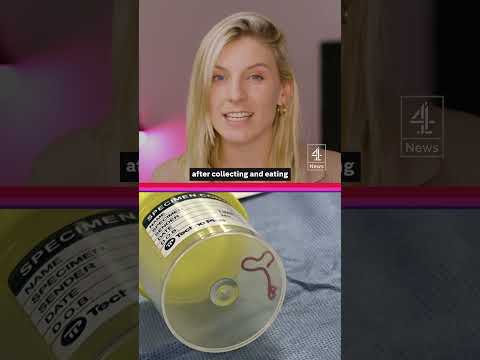 Worm found living inside woman’s brain