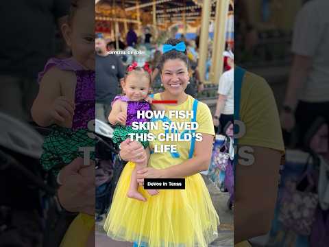 How fish skin saved this child’s life