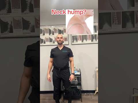 Neck hump? Try this and share!