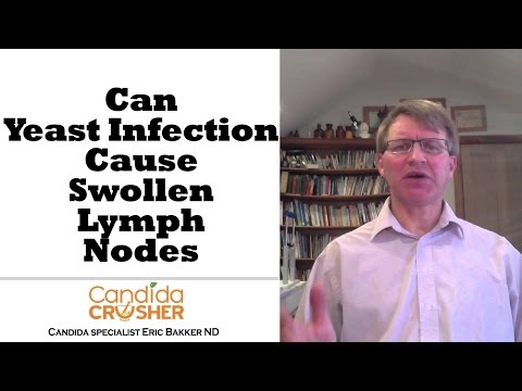 Can A Yeast Infection Cause Swollen Lymph Nodes? - YouTube