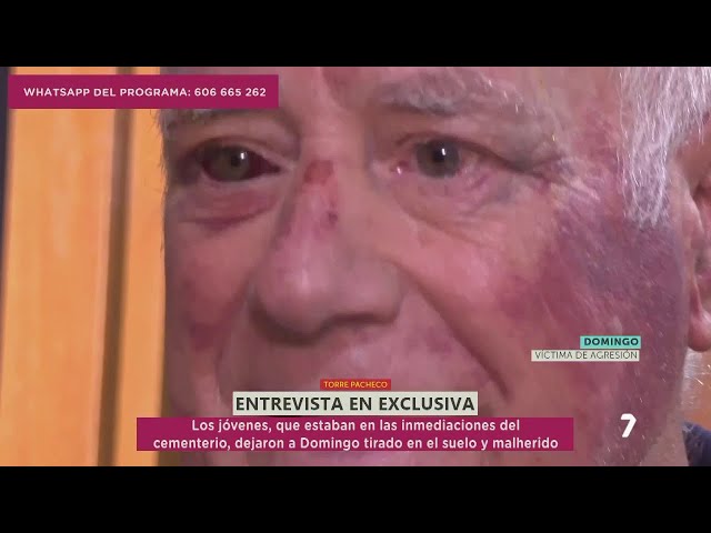 Domingo, víctima de la agresión en Torre Pacheco: "Tengo sensación de impotencia" | La 7