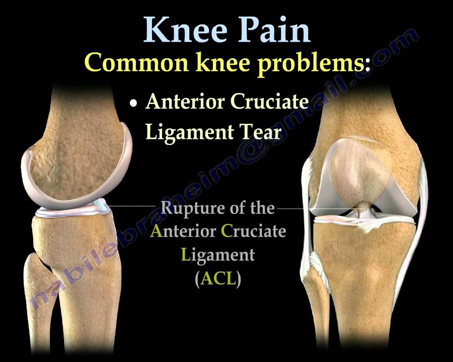 knee-pain-common-causes-everything-you-need-to-know-dr-nabil