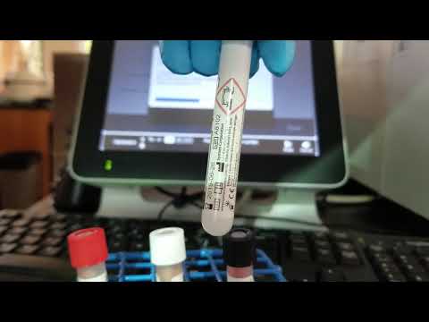 Hematology: Running Cell Clean Auto on the Sysmex XN-550 Analyzer