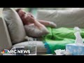 Doctors concerned over rising rate of the flu in parts of U.S.