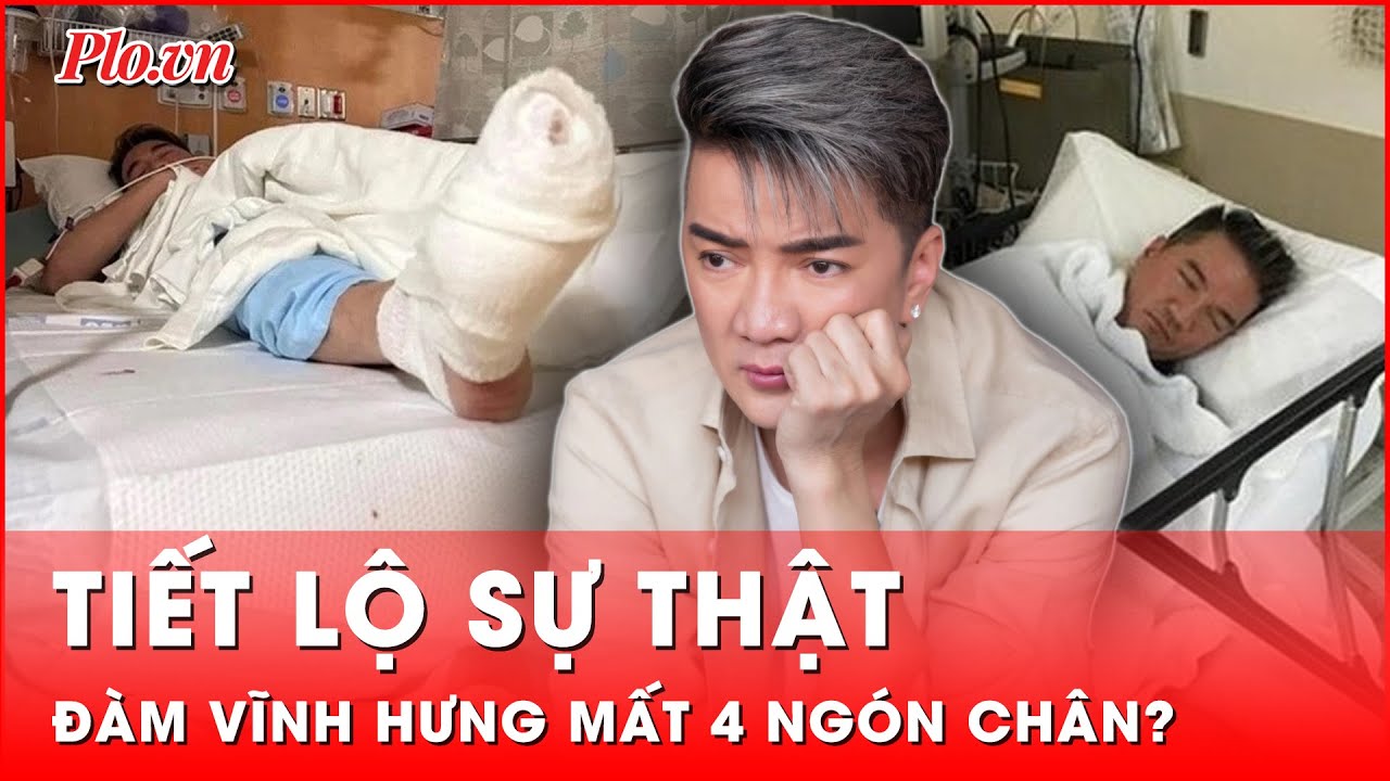 Tiết lộ sự thật về 4 ngón chân của Đàm Vĩnh Hưng | Hành trình phá án