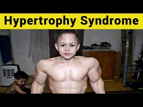 10 Rare Diseases That Give Superhero-Like Abilities