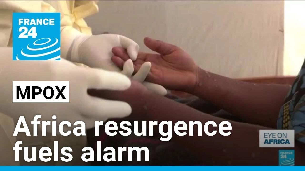 Africa mpox resurgence fuels alarm • FRANCE 24 English