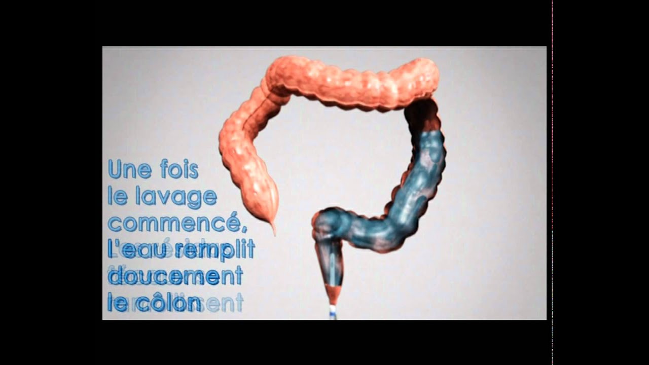 My Perfect Colon Lavage Du Côlon Chez Soi Youtube 