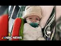 Infant born with rare heart defect receives first ever partial transplant