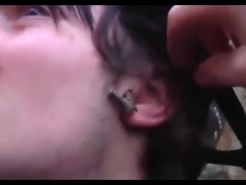 Stick in the head vs Screw in the foot | my UK Trip | Vlog #15 (Reupload)