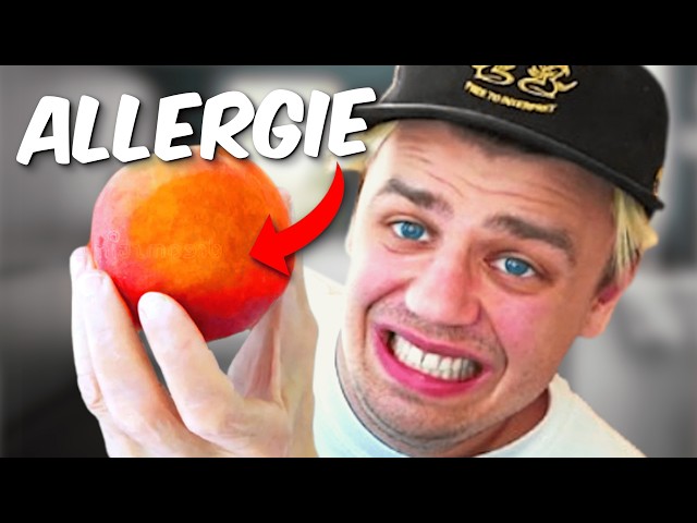 Ich versuche ALLES zu essen, worauf ich allergisch bin... (dumme Idee)