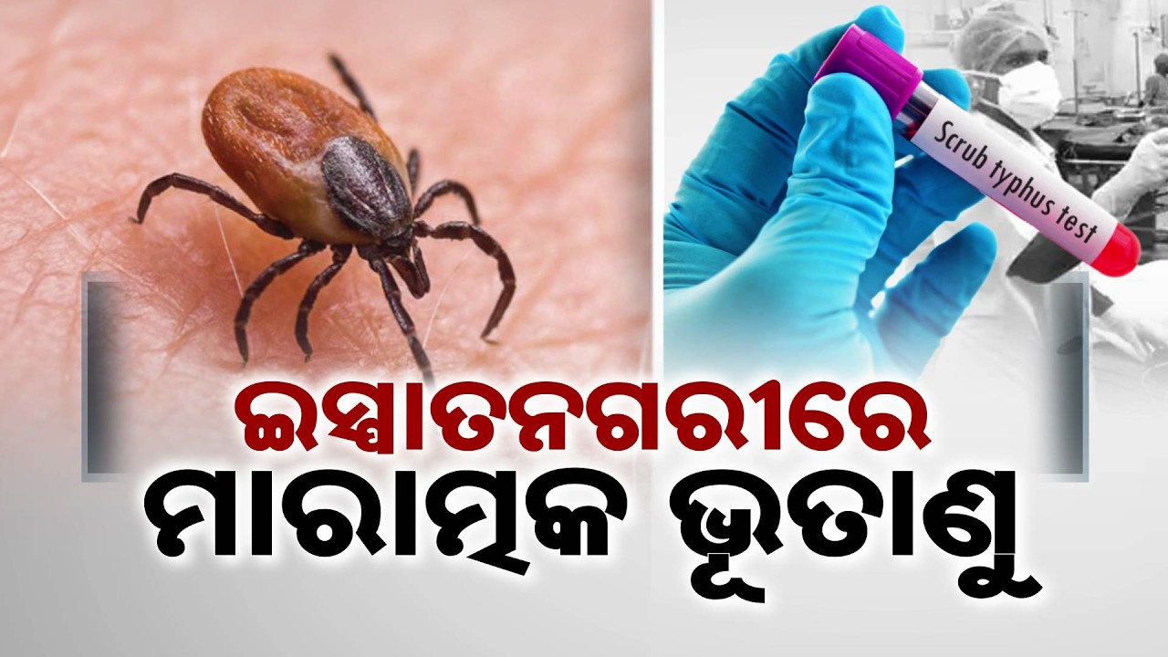 Scrub Typhus Outbreak In Sundargarh: Over 900 Cases, Rourkela On High Alert | Argus News