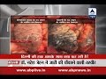 Scaring difference in lungs of two men, from Delhi and Himachal