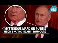 Putin underwent surgery? 'Mysterious mark' on Russian President's neck swirl speculations