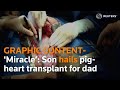 Miracle’: Son hails pig-heart transplant for dad
