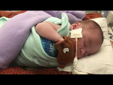 Cincinnati Children's is the first hospital in the nation to treat critically ill infants in renal failure with a new device designed to improve the outcomes for smaller, fragile babies. Cincinnati Children's is the first hospital in the nation to treat critically ill infants in renal failure with a new device designed to improve the outcomes for smaller, fragile babies.