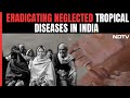 Indias Progress In Eliminating Neglected Tropical Diseases