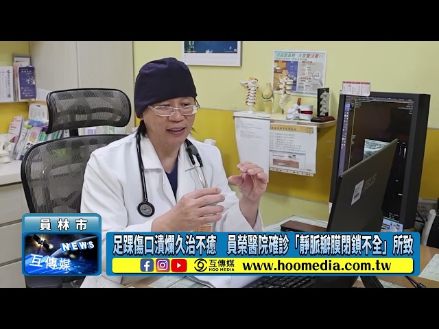 影／足踝傷口潰爛久治不癒 員榮醫院確診「靜脈瓣膜閉鎖不全」所致