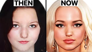 Dove Cameron's NEW FACE | Plastic Surgery Analysis