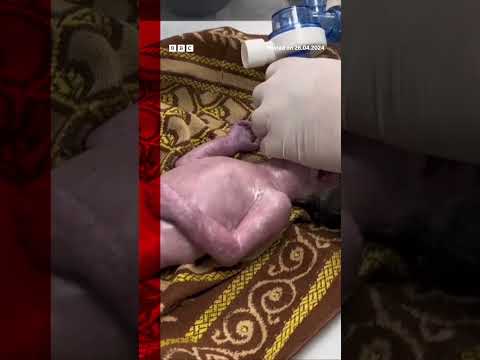 Baby saved from dead mother's womb in Gaza dies. #Shorts #BBCNews