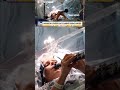 WATCH: Parkinsons patient plays clarinet DURING brain surgery #fox #news #foxnews #us #parkinsons
