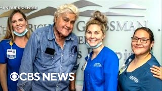 Comedian Jay Leno released from Los Angeles burn center