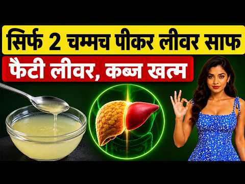 फैटी लीवर का इलाज-फैटी लीवर की आयुर्वेदिक दवा-Fatty Liver Kaise Theek Karen -How To Cure Fatty Liver