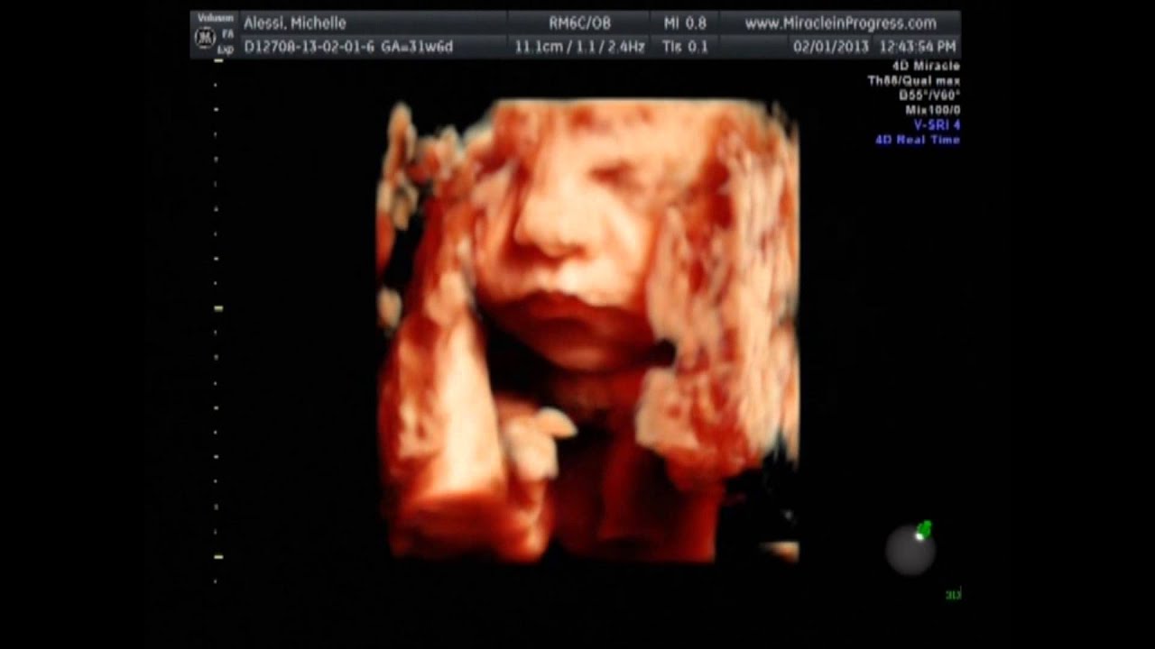 3D/4D Ultrasound in HD....Baby Carly 32 weeks YouTube