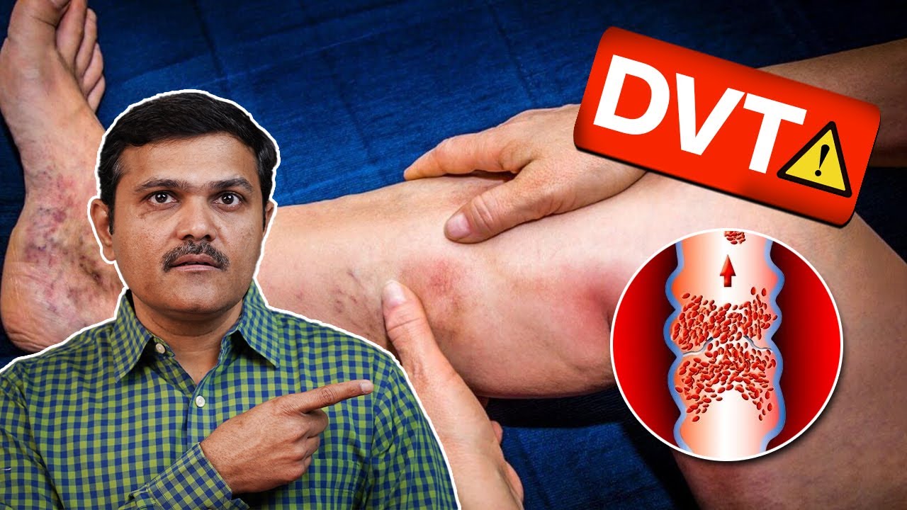 Vascular Endovascular Video Gallery Dr Sumit Kapadia vascular-endovascular-video-gallery-dr-sumit-kapadia