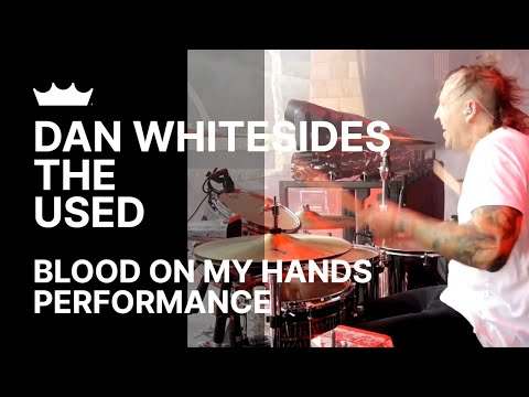Dan Whitesides / The Used: Blood On My Hands | Remo