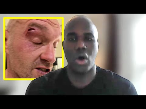 ‘tyson fury cut was careless! ’ – darren sealy on usyk spars and anthony joshua camp