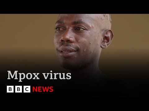 New strain of Mpox spreading rapidly in central Africa | BBC News