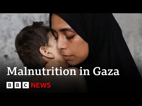 Warnings of malnutrition in Gaza as Donald Trump says Hamas won’t agree ceasefire | BBC News