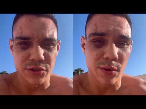 HEARTBROKEN Tim Tszyu AFTER BEING STOPPED against Sebastian Fundora in their REMATCH