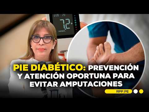 Prevención y el cuidado oportuno del pie diabético #ENCENDIDOSRPP