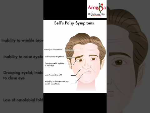 Bell's Palsy Exercises: Arogya physiotips #bellspalsy #facialexercise