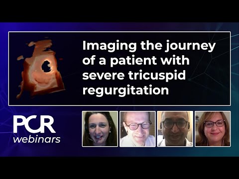 Imaging the journey of a patient with severe tricuspid regurgitation – Webinar