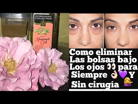 El hinchazón kvinke ante los ojos los primeros auxilios