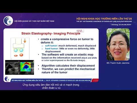 4. Ứng dụng siêu âm đàn hồi mô và vi mạch trong chẩn đoán u vú (BS. Thanh Xuân Jasmine)