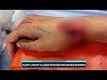 New Mexico family sues school over injury after sword fight  - 02:29 min - News - Video